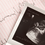 God IS Good Even When We Don’t Understand